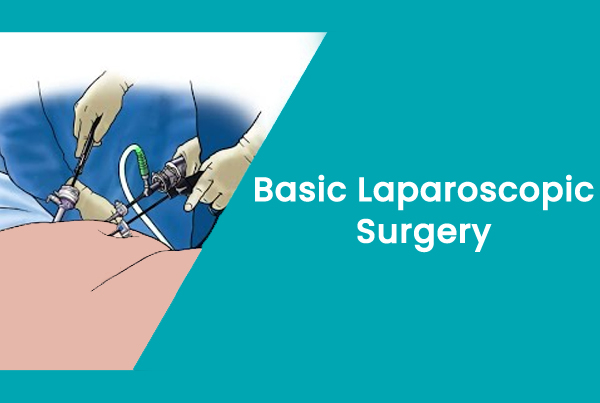 Basic Laparoscopic Surgery